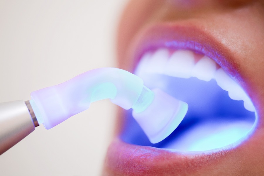 Close up of a mouth with UV light being used to screen for oral cancer