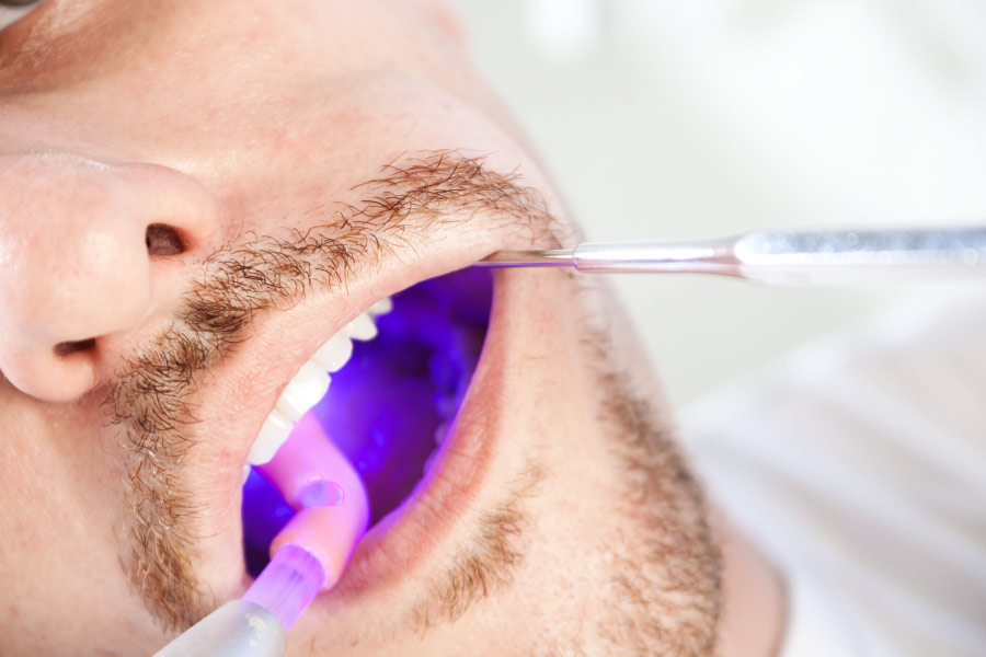 Man getting screened for oral cancer at the dentist.