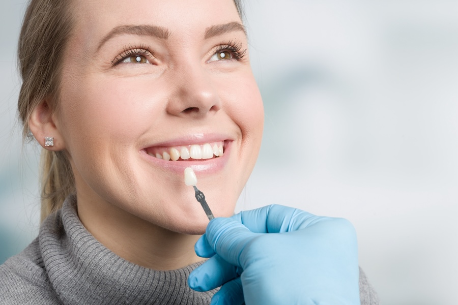 veneers, veneer consultation, dental veneers, Bethea Family Dentistry, Columbia SC, veneer treatment, personalized veneer planning, dental consultation, cosmetic dentistry