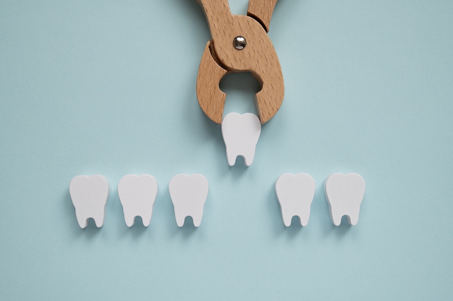 what happens after tooth extraction empty space